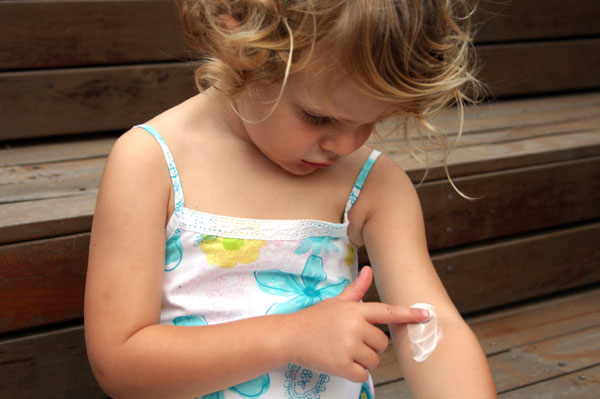 child-with-eczema-applying-lotion